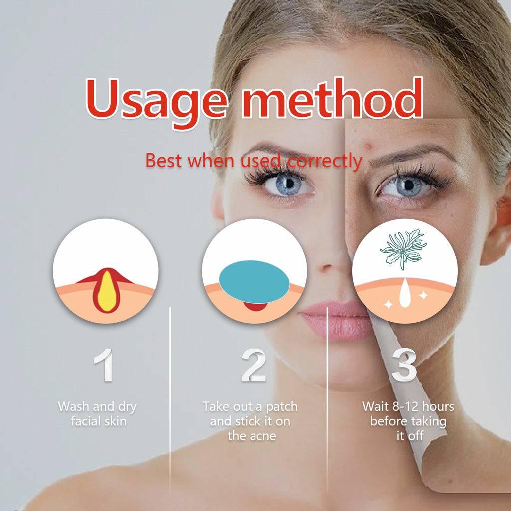 Hydrocolloid Acne Patch, Mild Non-Irritant Lightening Acne Pimples Closed Mouth Improve Acne Muscle Hydrocolloidal Acne Patch
