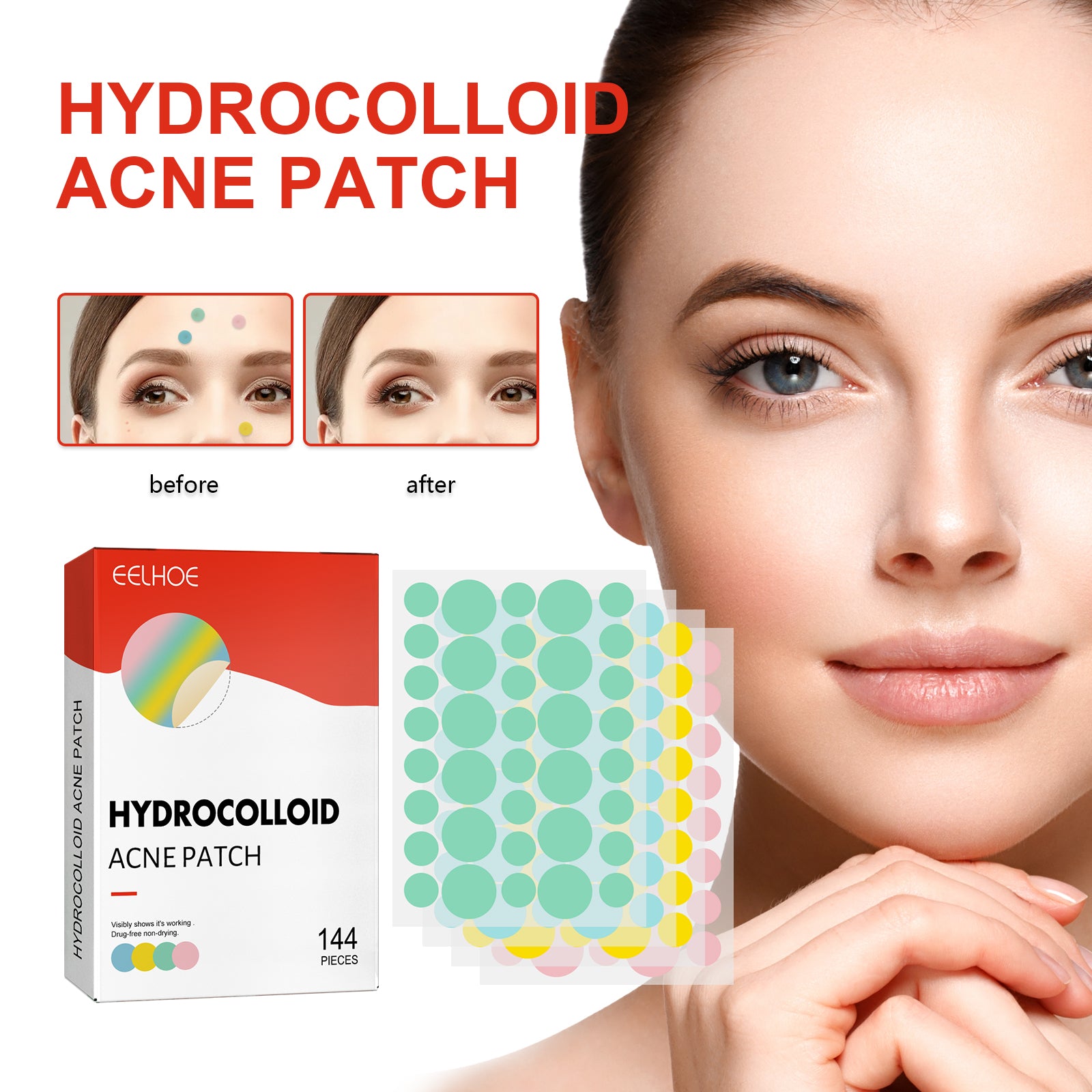 Hydrocolloid Acne Patch, Mild Non-Irritant Lightening Acne Pimples Closed Mouth Improve Acne Muscle Hydrocolloidal Acne Patch
