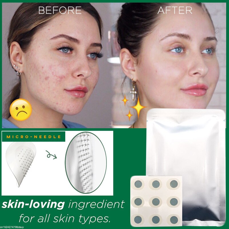9 Patches Microneedle Acne Pimple Healing Patch Anti Acne Pimple Patch Soothing Face Skin Healing Zit Stickers Blemish Treatment