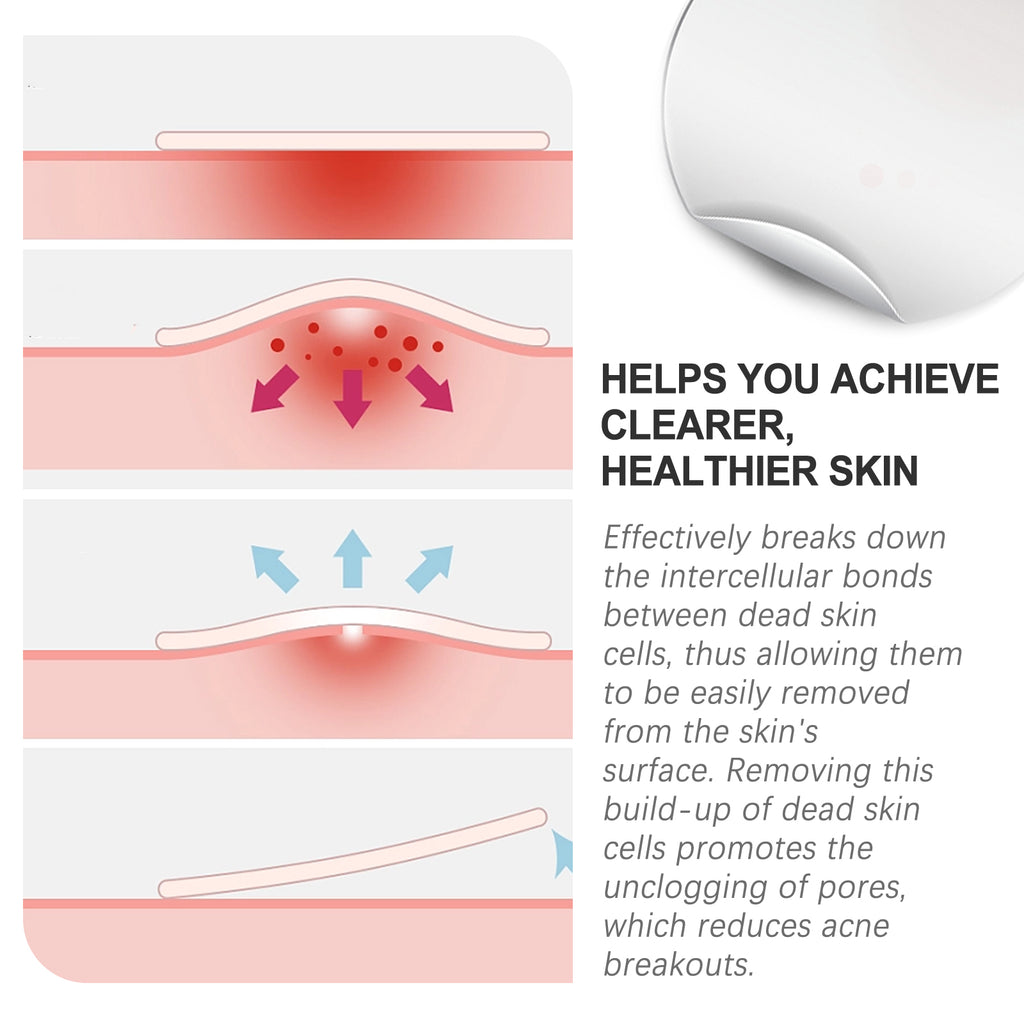 West&Month Acne Patch, Repair Acne Pimples Acne Invisible Concealer Breathable Acne Patch