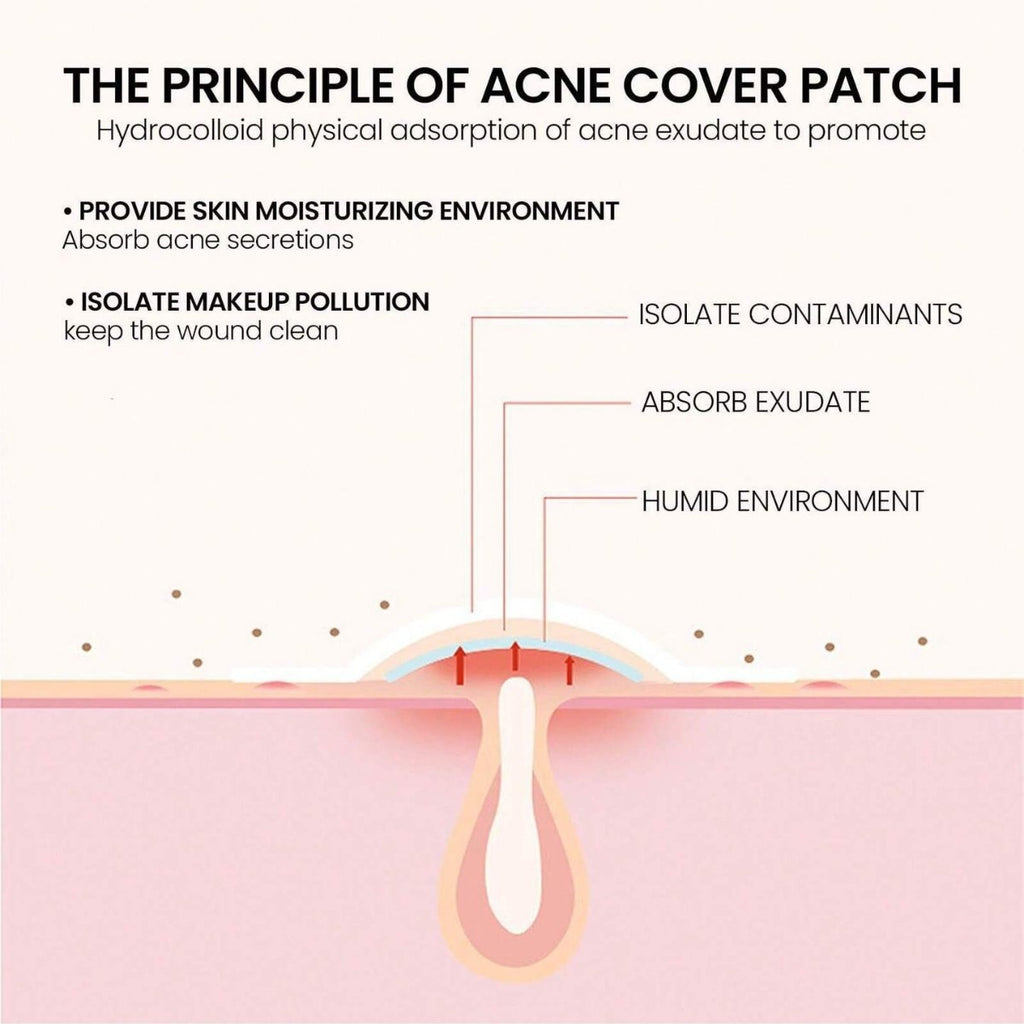 200 Pieces Acne Patches Party Stickers Heart-shaped Stickers Star Decorative Stickers Halloween Acne Patches