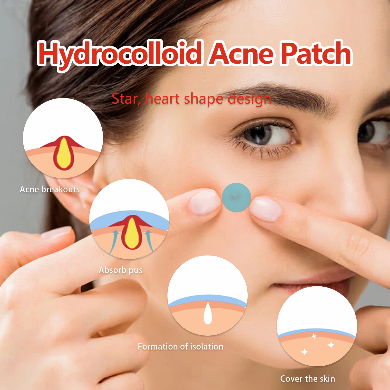 Hydrocolloid Acne Patch, Mild Non-Irritant Lightening Acne Pimples Closed Mouth Improve Acne Muscle Hydrocolloidal Acne Patch