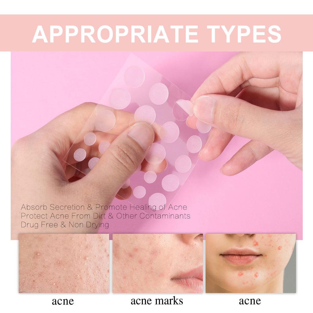 West&Month Acne Patch, Repair Acne Pimples Acne Invisible Concealer Breathable Acne Patch